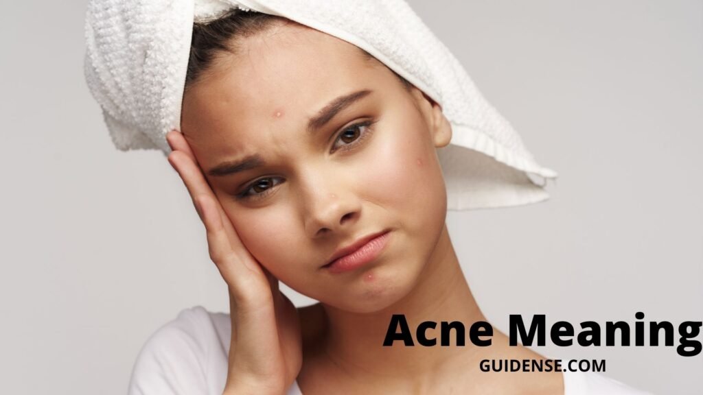 Acne Meaning